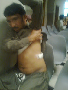 Rev.Pervaiz John in General Hospital Lahore after attacked.