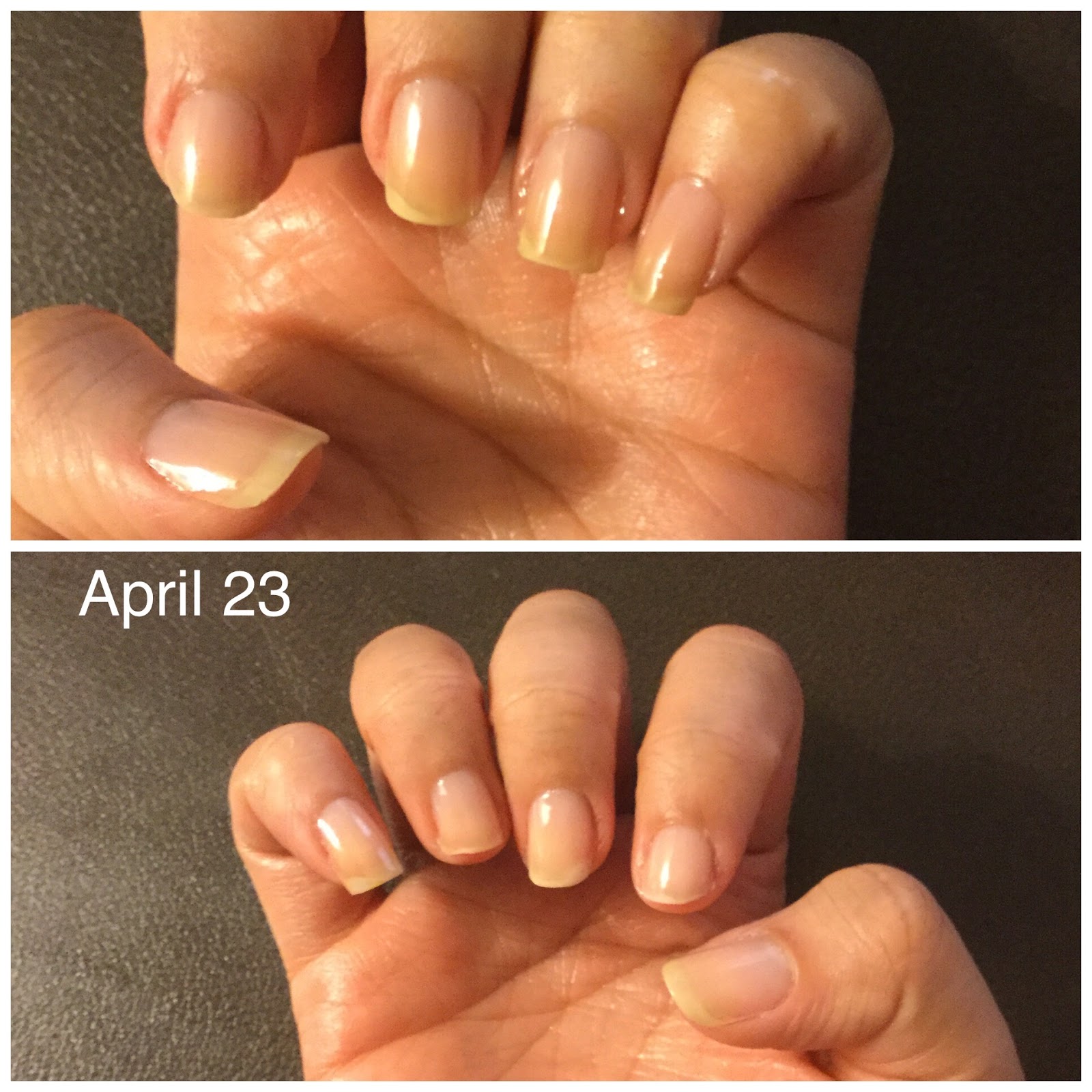 How to Save and Regrow Nails After a Break