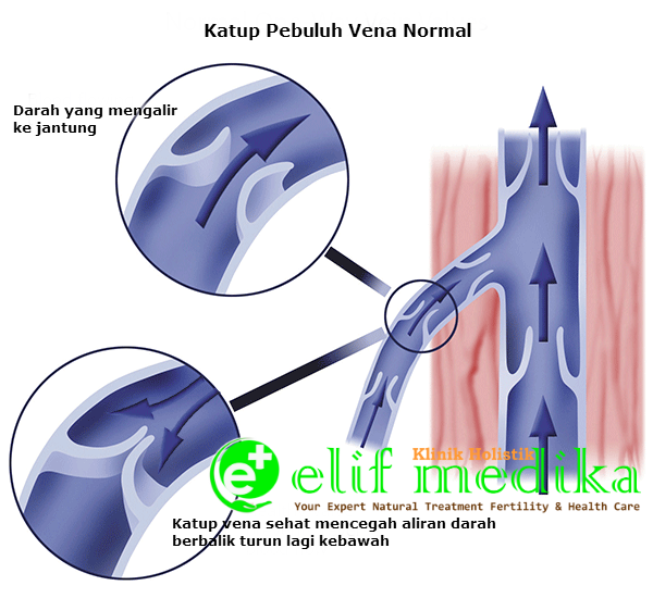 Katup Pebuluh Vena Yang Normal Katup Pebuluh Vena Yang Normal