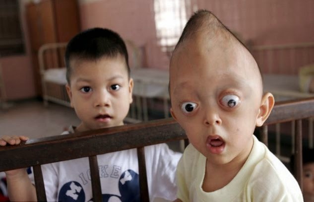 Orphans of Agent Orange: 50 years on children suffer from effects of U