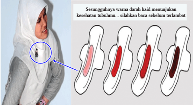 Wanita mohon dibaca tulisan ini! ketika kamu haid lihatlah warna darah nya, karena Bisa menunjukan Kesehatan Tubuhmu... Lihat no 3, sungguh membahayakan !! Wanita mohon dibaca tulisan ini! ketika kamu haid lihatlah warna darah nya, karena Bisa menunjukan Kesehatan Tubuhmu... Lihat no 3, sungguh membahayakan !!