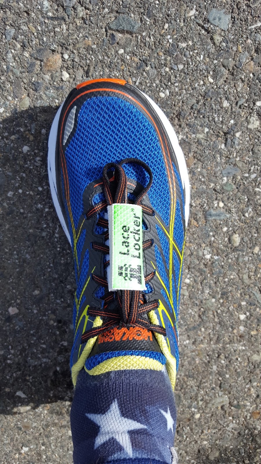 Running Without Injuries: Lace Locker Review