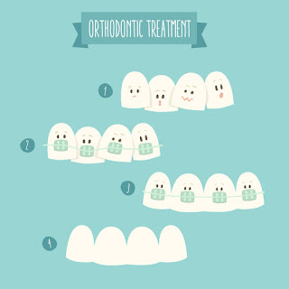 Littleton orthodontist treatment plan