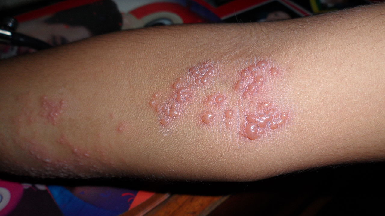 Skin Diseases Names With Pictures Nurses Notes