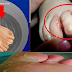Tolong Bantu SHARE Ke-Yang Lain'Nya"..Kutu Air Menyerang Anda..?? Tenang Jangan Kuatir, Rendamkan Kaki Anda Selama 15 Menit Dengan Bahan Dapur Ini..!!! Kutu Air Anda Akan Hilang Tampa Berbekas.."Berikut Caranya..!!!!!