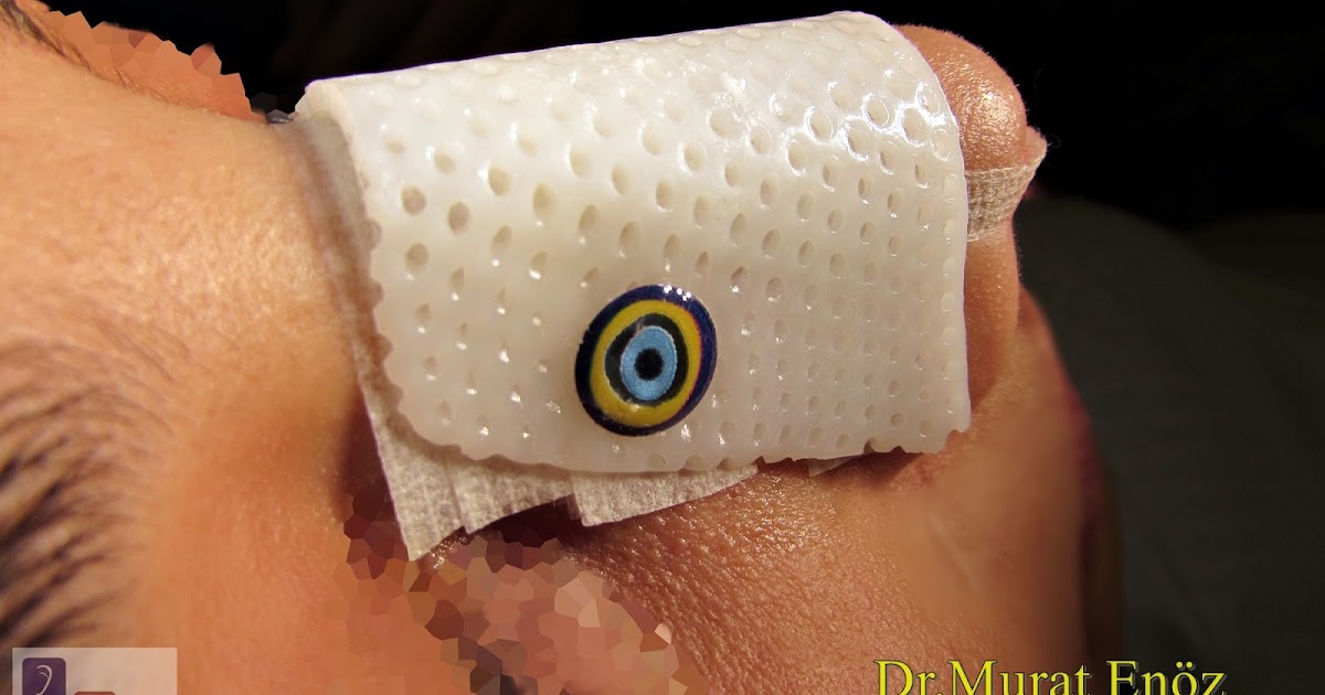 Health Zone Turkey Bandage After Rhinoplasty and Nasal Silicone Splints