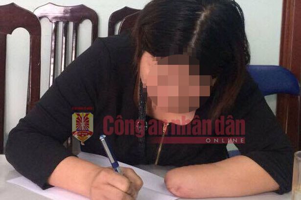 Demi Uang Asuransi, Wanita Ini Nekat Potong Tangan dan Kakinya Sendiri Demi Uang Asuransi, Wanita Ini Nekat Potong Tangan dan Kakinya Sendiri