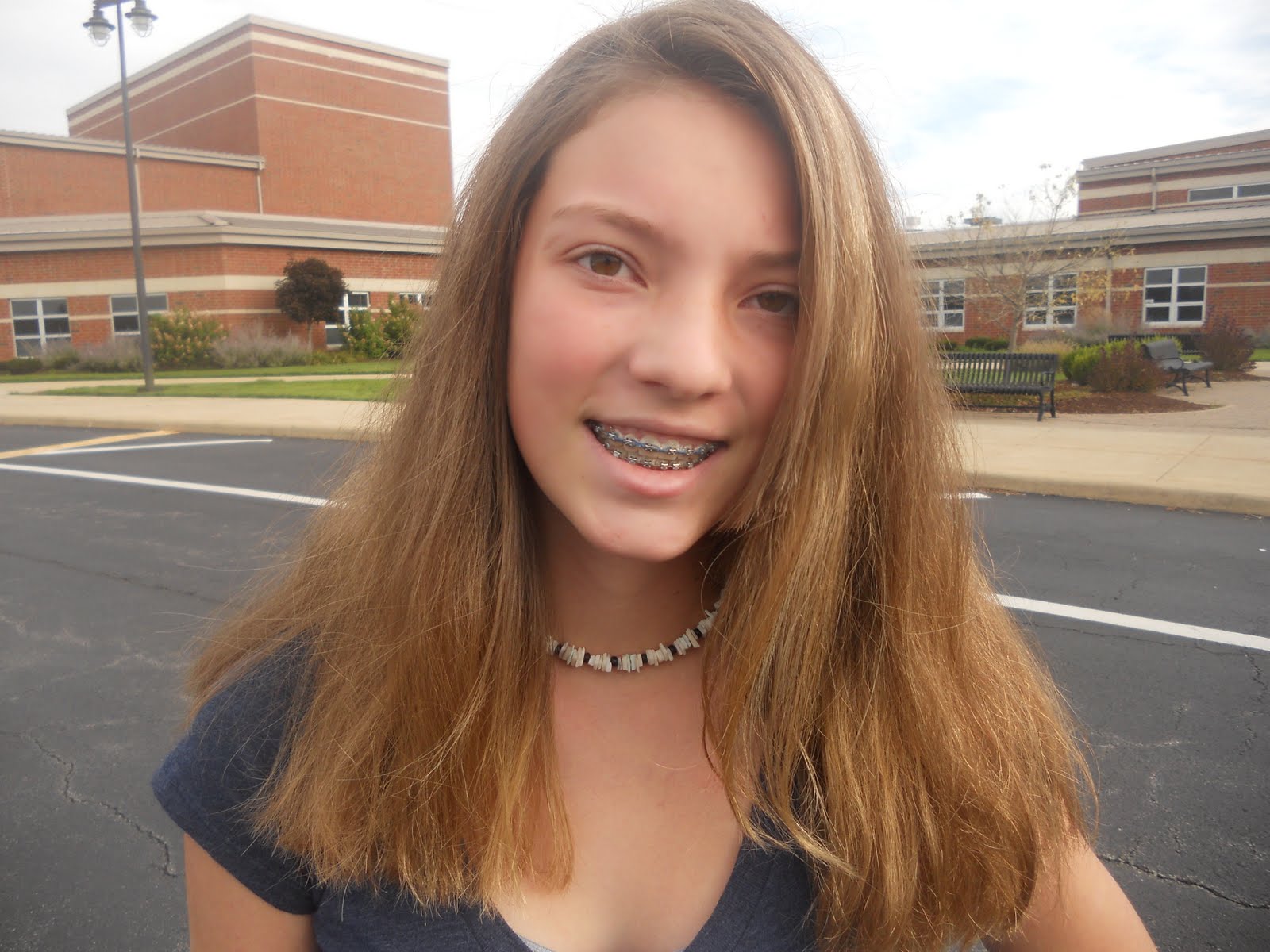 Palm Tree Fanatic Jelena Getting Her braces off