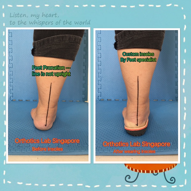The Best Shoe Inserts For Flat Feet The Best Shoe Inserts For Flat Feet