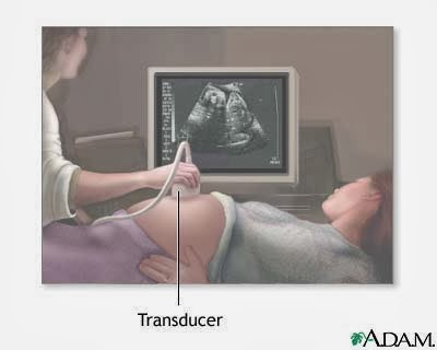 My Pregnancy Journey Part 7 : Kenapa Buat Ultrasound Scan Ketika Hamil