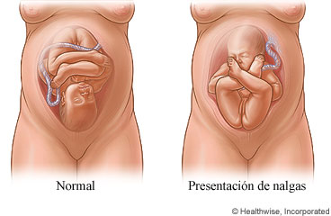 33 semanas de embarazo posicion del bebe