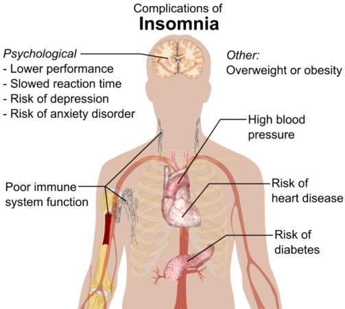 Cara Alami Mengatasi Insomnia