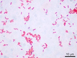 Mengapa Bakteri Gram Negatif Bersifat Patogen - Dulajar