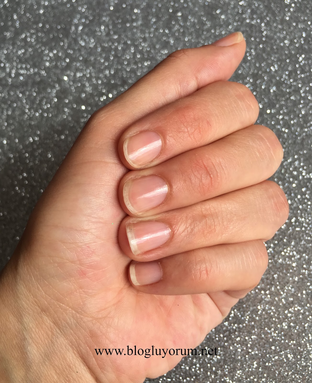 RIMMEL LONDON NAIL RESCUE NAIL NURSE 14 GÜNLÜK TIRNAK BAKIM CİLASI