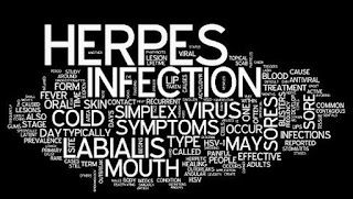 obat herpes genital ampuh di apotik