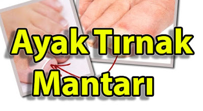 ayak tırnak mantarı ayak tırnak mantarı