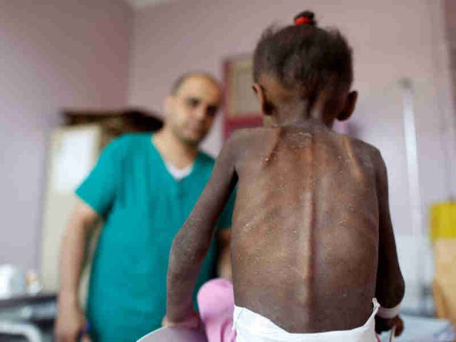 Yemen's Children Suffer 'Devastating Toll' in 5-Year Conflict, Virginia Gamba Says Yemen's Children Suffer 'Devastating Toll' in 5-Year Conflict, Virginia Gamba Says