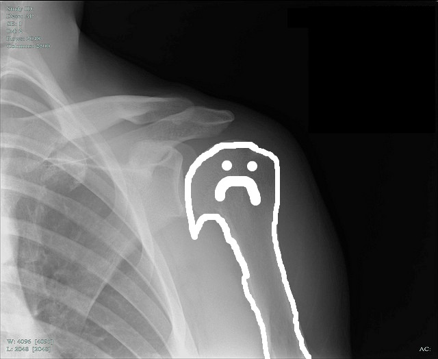 Image result for funny shoulder x-ray