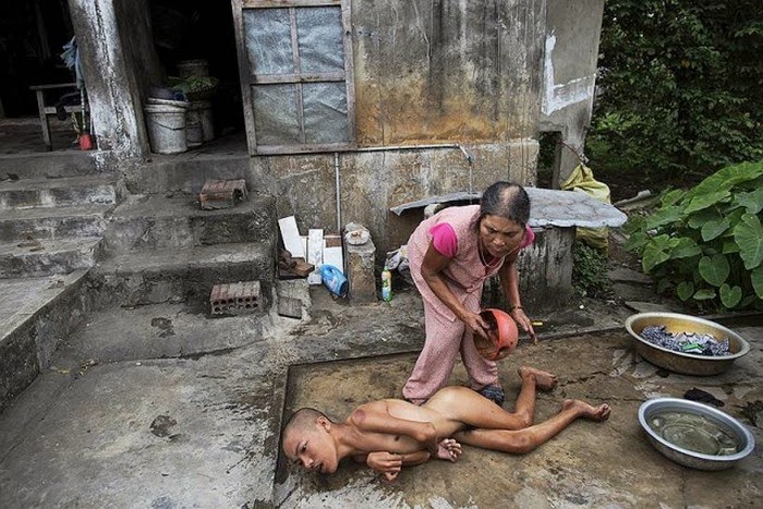 Efek Mengerikan 40 Tahun Perang Vietnam img
