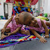 Bangladeshi conjoined twins expect surgery