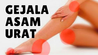 Ciri Ciri Asam Urat Dan Obatnya, Tumbuhan Obat Asam Urat Dan Rematik, Obat Asam Urat Alami Tradisional, Asam Urat Di Pergelangan Tangan, Cara Menurunkan Asam Urat Dan Darah Tinggi, Tips Mengurangi Rasa Sakit Asam Urat, Asam Urat Video, Penyebab Asam Urat Kaki, Untuk Mengatasi Penyakit Asam Urat, Cara Mengurangi Rasa Sakit Saat Asam Urat Kambuh, Cara Mengobati Asam Urat Yang Tinggi, Resep Obat Sakit Asam Urat, Asam Urat Normal Laki Laki Dan Perempuan, Angka Asam Urat Yang Normal, Cara Mengatasi Asam Urat You Tube, Cara Pengobatan Sakit Asam Urat, Asam Urat Udang, Obat Ramuan Penyakit Asam Urat, Asam Urat Faktor Resiko, Gambar Test Asam Urat, Obat Herbal Ampuh Buat Asam Urat, Coklat Bagi Asam Urat, Obat Herbal Asam Urat Kaki Bengkak, Asam Urat Cara Mengobatinya, Asam Urat Buah Pantangan, Obat Asam Urat Mengkudu, Obat Asam Urat Alami Manjur, Obat Asam Urat Dan Rematik Di Apotik, Obat Asam Urat Ampuh Di Apotik, Obat Asam Urat Jangka Panjang