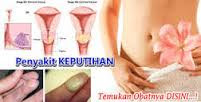 Obat Merapatkan Vagina/ Organ Kewanitaan di Karawang Obat Merapatkan Vagina/ Organ Kewanitaan di Karawang