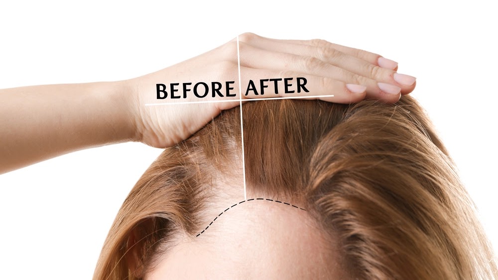 Apakah Aloe Vera bermanfaat untuk pertumbuhan pada rambut? Pertumbuhan Rambut