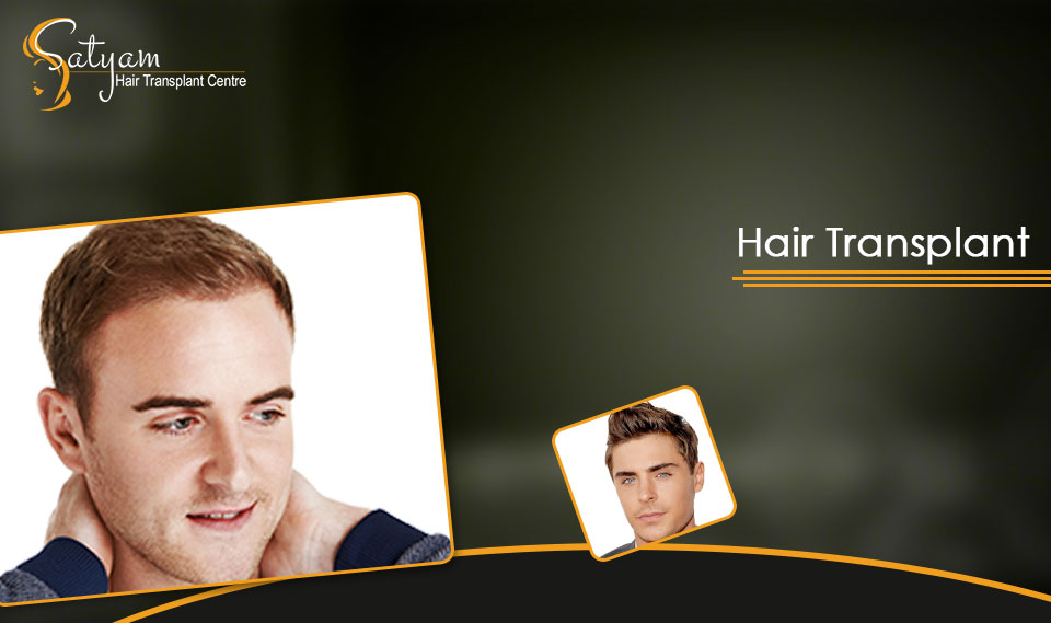 Satyam Hair Transplant Australia Hair Transplant A Perfect Solution