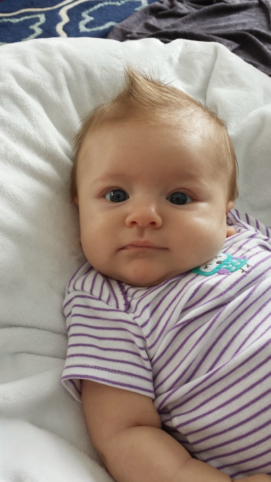 Sarcastic Parent The Torment that is...Cradle Cap