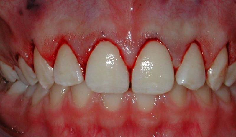 Sağlıksız Olduğunuzu Gösteren 8 İşaret https://www.listeblogu.com/2019/01/saglksz-oldugunuzu-gosteren-8-isaret.html