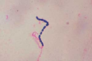Estreptococos, uno de los subtipos de bacterias Clasificación de las bacterias según diferentes criterios