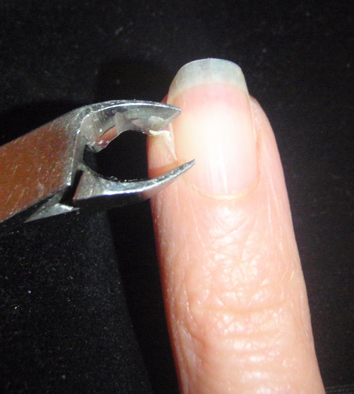 How to Handle a Hangnail