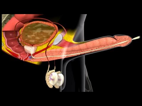 Prostate cancer masturbation study There's prostate cancer masturbation study the point