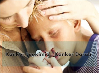 Obat kanker leukimia