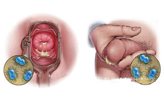 Penis Keluar Cairan Kuning Apakah Berbahaya Penis Keluar Cairan Kuning Apakah Berbahaya