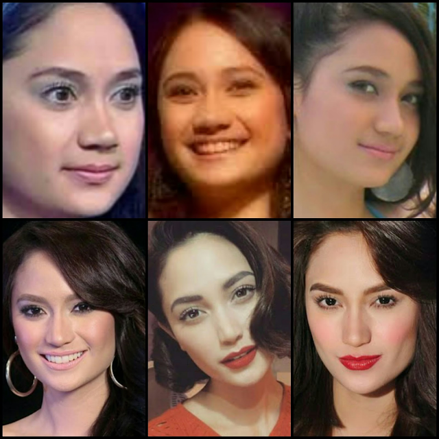 Before and After Photos of 10 Pinoy Celebrities Unrecognizable After Fame. Check Here and Be Amaze!