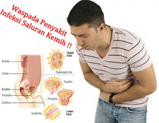 Apa itu isk dan bagaimana cara mengobati isk Apa itu isk dan bagaimana cara mengobati isk