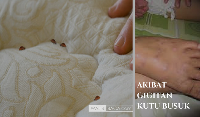 Ada yang Masih Kesal Dengan Kutu di Kasur? Ini Cara Ampuh Basmi Kutu Busuk Ada yang Masih Kesal Dengan Kutu di Kasur? Ini Cara Ampuh Basmi Kutu Busuk