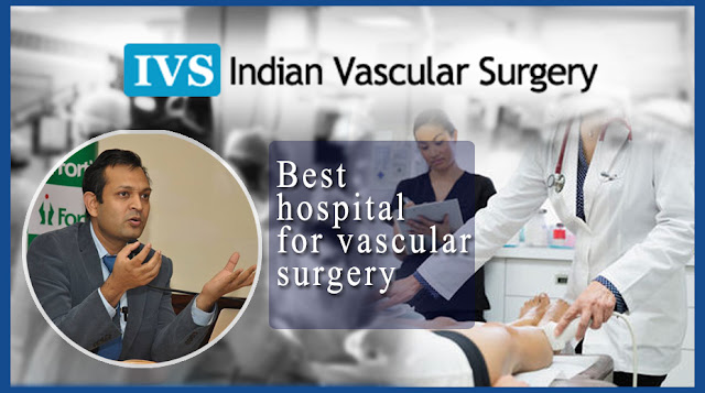 Best hospital for vascular surgery