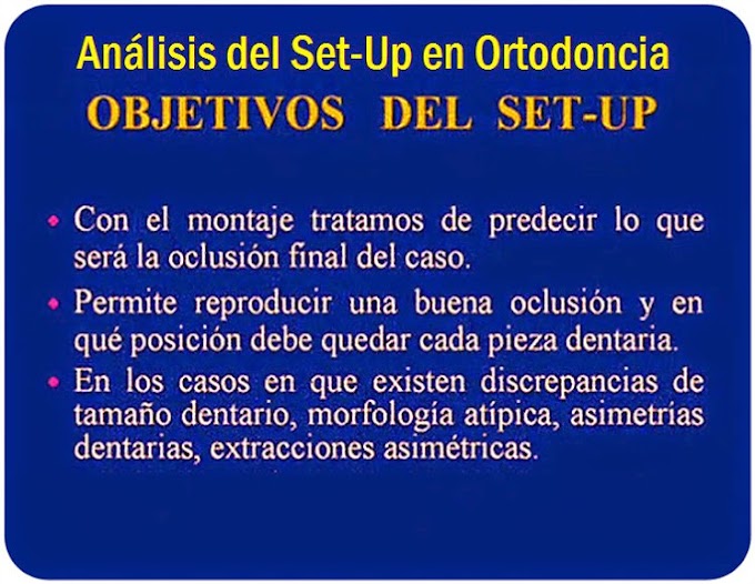 SET-UP en Ortodoncia: Análisis