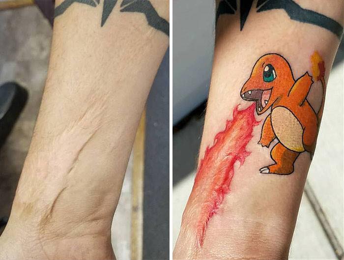 CICATRIZES TRANSFORMADAS EM TATUAGENS PELAS MÃOS DE TATUADORES SUPER CRIATIVOS