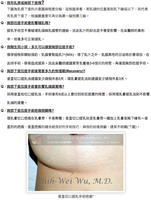 胸部下垂拉提手術需知 胸部下垂拉提手術需知
