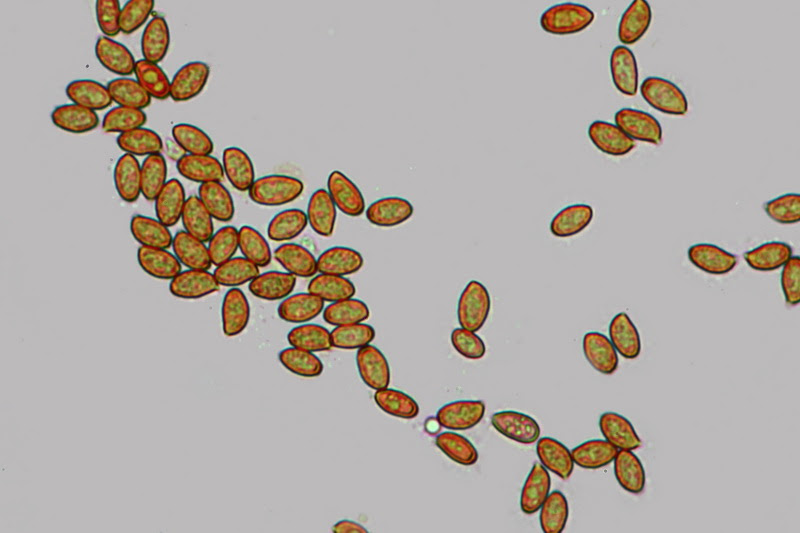 Desgastado Cita Él mismo El mundo microscópico de los hongos: El Microscopio