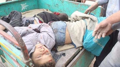 أطفال الغوطة أطفال الغوطة