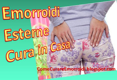 Cura di emorroidi da anelli di prezzo