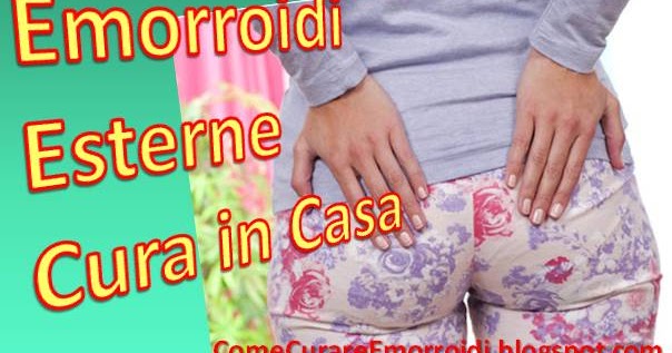 Che fare se la vena su una gamba prude