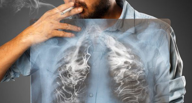 Causes Of Lung Cancer