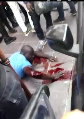 La policía de Cambiemos molió a palos a un vendedor senegalés: fractura expuesta, corte de tendones y complicaciones en una arteria. Perdió mucha sangre