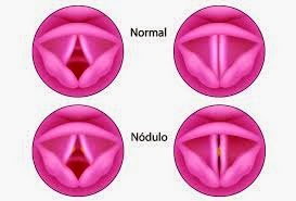 ESBOZOS NODULARIS PDF DOWNLOAD ESBOZOS NODULARIS PDF DOWNLOAD