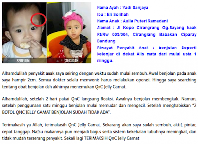 Cara Menghilangkan Benjolan Lunak Di Lubang Hidung Cara Menghilangkan Benjolan Lunak Di Lubang Hidung